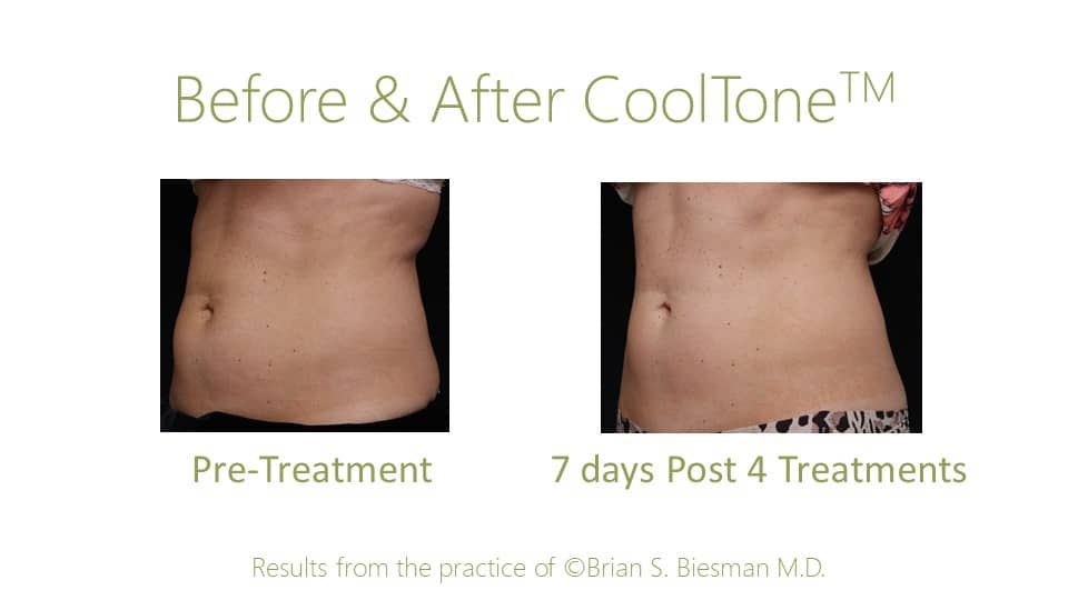 Cooltone LFT 45 pre post