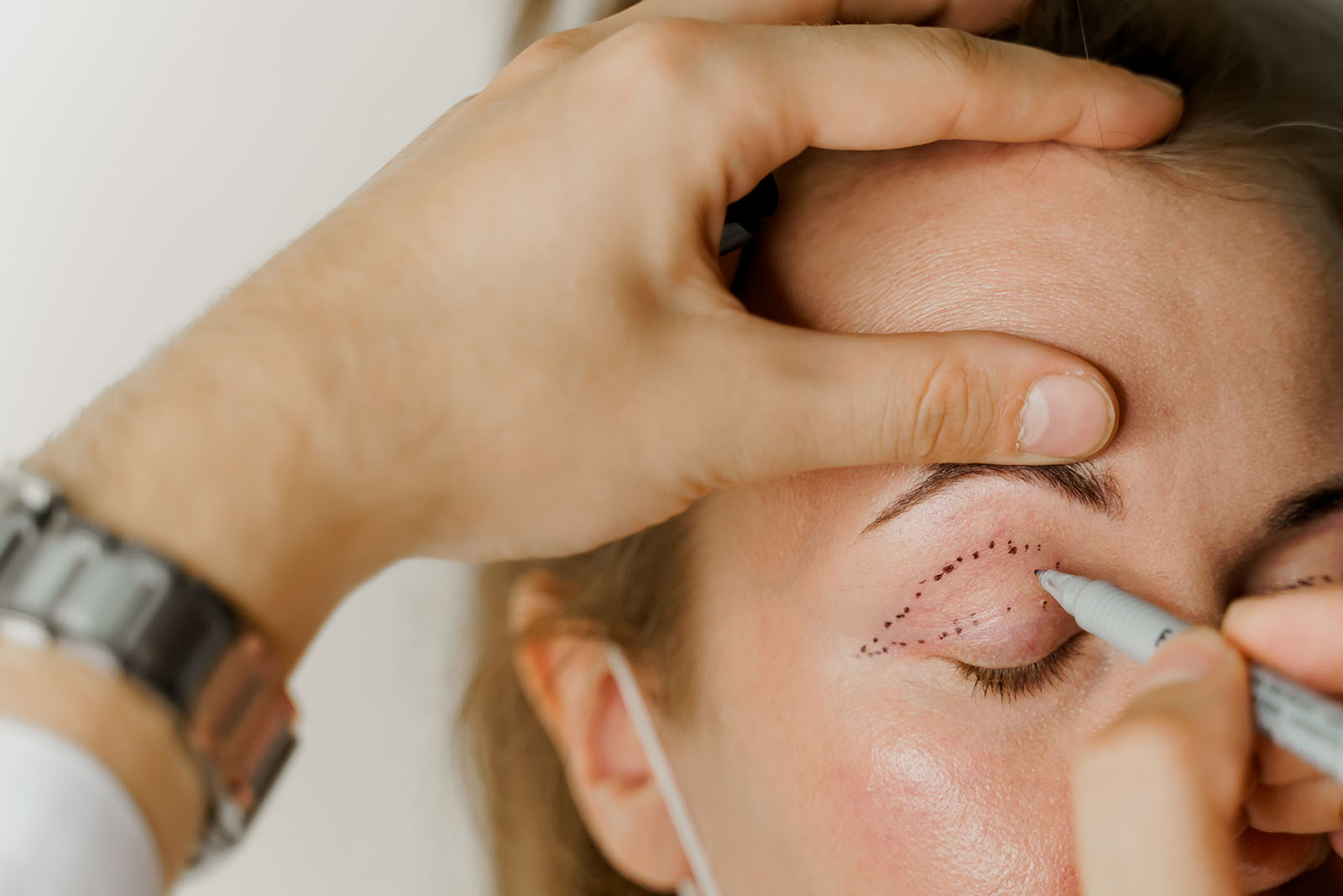 Eyelid Surgery in Nashville TN