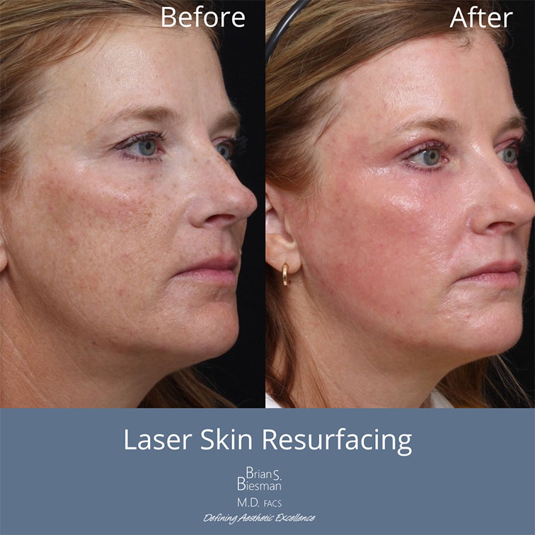 sunspot treatment Nashville